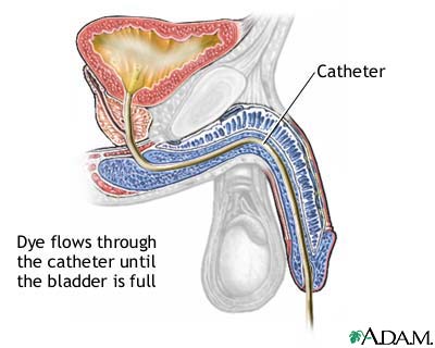 Cystography