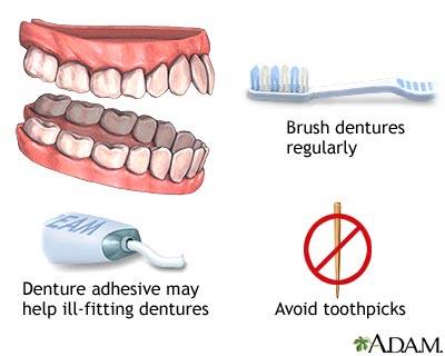 Denture care