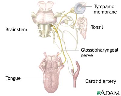 Glossopharyngeal neuralgia