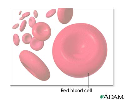 Hypochromia