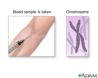 Karyotyping