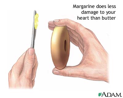 Margarine vs butter