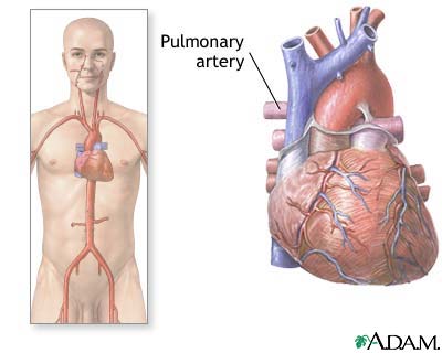 Pulmonary arteries