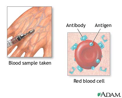 Herpes biopsy