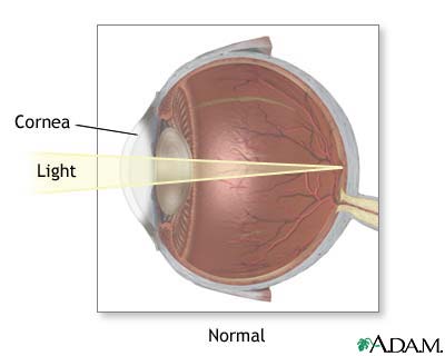 Normal vision