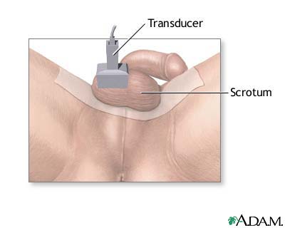 Testicular ultrasound