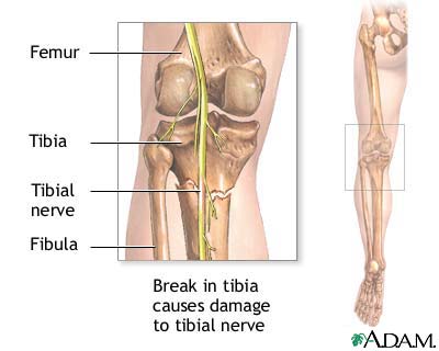 Tibial nerve