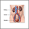 Kidney transplant - series