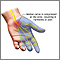 Carpal tunnel syndrome