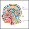 Ventriculoperitoneal shunt - series