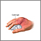 Hand splint - series