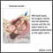 Cesarean section