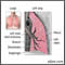 Lung anatomy