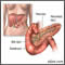 Pancreas