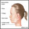 Infectious mononucleosis