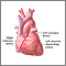 Heart bypass surgery - series