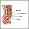 Amniocentesis - series