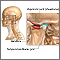 Causes of secondary headache