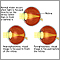 Normal, nearsightedness, and farsightedness