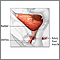 Bladder and urethral repair  - series