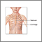 Pectus excavatum repair  - series