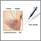 Female breast biopsy