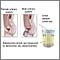 Aldosterone level test