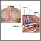 Thoracic outlet anatomy