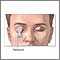 Head and eye Echoencephalogram