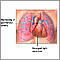 Primary pulmonary hypertension