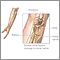 Ulnar nerve damage